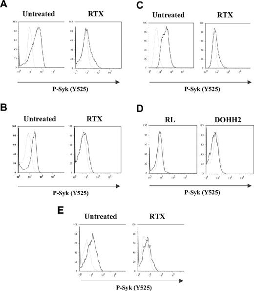 Figure 1. Effect of RTX on BCR activation in FL cell lines and normal B cells. RL (A,C) or DOHH2 (B) cells were incubated for 16 hours with 10 μg/mL of RTX or F(ab′)2 RTX, respectively, and then treated with anti-IgM or anti-IgG antibodies (10 μg/mL) during 5 minutes (A-B) or 2 hours (C). Nonstimulated and stimulated cells are represented by gray and black histograms, respectively. (D) RL or DOHH2 cells were treated with RTX or F(ab′)2 RTX, respectively (10 μg/mL, 16 hours). Untreated and treated cells with RTX are represented by gray and black histograms, respectively. (E) PBMCs isolated from healthy donors were incubated with F(ab′)2 RTX (10 μg/mL, 16 hours) and then treated with a mixture of anti-IgM/IgG antibody (10 μg/mL, 5 minutes). Nonstimulated and stimulated cells are represented by gray and black histograms, respectively. Syk phosphorylation on Y525 was measured by flow cytometry. Results are representative of at least 3 independent experiments.