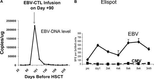 Figure 3. Representative clinical response. An 18-month-old boy with XLP presented at day 87 after matched unrelated donor transplantation with pharyngeal swelling, an elevated lactate dehydrogenase level, and a rapidly increasing EBV-DNA load. (A) After receiving 2 × 107 CTLs/m2 on day 90, he showed rapid clinical improvement and a decrease in EBV DNA level to baseline. (B) Coincident with this response, there was an increase in EBV-specific activity, as measured with a γ-interferon EliSpot assay, whereas CMV activity remained undetectable.