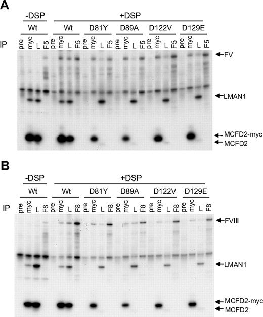 Figure 3. MCFD2 missense mutations identified in F5F8D patients do not abolish crosslinking to FV and FVIII. COS-1 cells were cotransfected with the wild-type or indicated MCFD2 missense mutants along with either FV (A) or FVIII (B). Cells were incubated with or without DSP before lysis. Cell lysates were immunoprecipitated with preimmune serum (pre), anti-myc (myc), anti-LMAN1 (L), and either anti-FV (F5 in panel A) or anti-FVIII (F8 in panel B) antibodies.