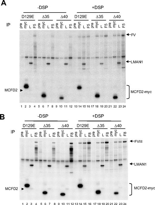 Figure 4. N-terminal domain of MCFD2 is not required for binding to FV and FVIII. COS-1 cells were cotransfected with the D129E missense mutant MCFD2 or N-terminal deletion mutants (Δ35 and Δ40) and FV (A) or FVIII (B). Both deletion mutants also contain a D129E missense mutation. Cells were metabolically labeled 20 hours after transfection, incubated with or without DSP before lysis. Cell lysates were immunoprecipitated with preimmune serum (pre), anti-myc (myc), anti-LMAN1 (L), and either anti-FV (F5 in panel A) or anti-FVIII (F8 in panel B) antibodies. Arrowheads indicate the endogenous MCFD2 bands.