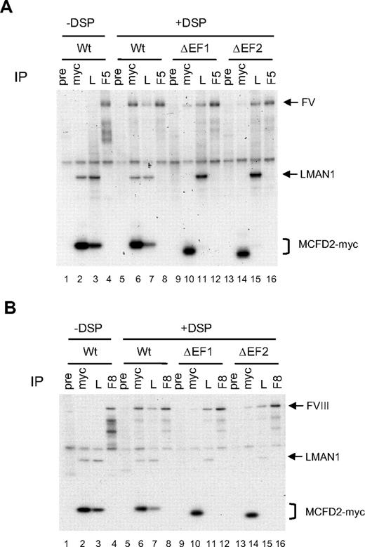 Figure 6. Deletion of either EF-hand domain of MCFD2 markedly decreases its interaction with FV and FVIII. COS-1 cells were cotransfected with the wild-type or the EF hand deletion mutants along with either FV (A) or FVIII (B). Cells were incubated with or without DSP before lysis. Cell lysates were immunoprecipitated with anti-myc (myc), anti-LMAN1 (L), and anti-MCFD2 (M).