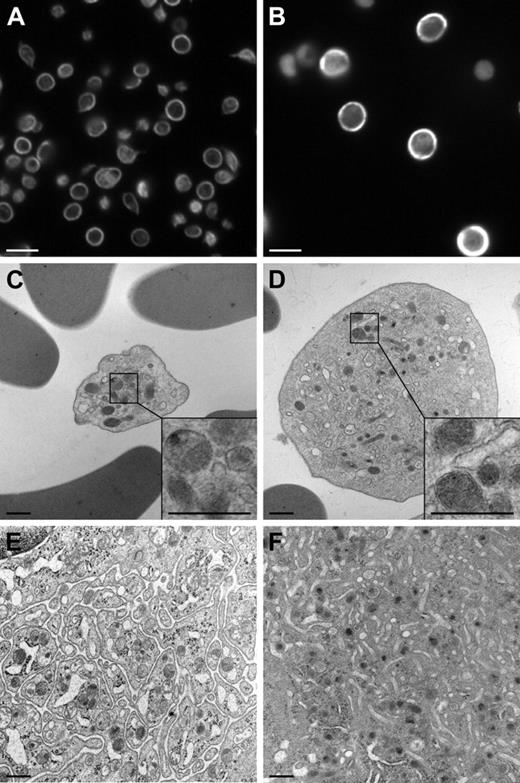 Figure 3. Immunofluorescent and transmission electron microscopic changes in platelets and megakaryocytes. (A-B) Immunofluorescence photomicrographs of platelets stained with anti–β1-tubulin antibody at 1000 ×; bars represent 5 μM. (A) A/J +/? control platelets showing normal β1-tubulin immunoreactivity. (B) Enlarged A/J-trac/trac platelets showing increased β1-tubulin immunoreactivity. (C-F) TEM of platelets and megakaryocytes. (C) A/J +/+ platelet showing normal structure. (D) A/J-trac/trac platelet showing large size, numerous small alpha granules, and increased numbers of mitochondria in each platelet. (E) A/J +/+ megakaryocyte showing well-developed platelet demarcation membrane system (DMS). (F) A/J-trac/trac megakaryocyte showing altered DMS. (C-F) Bars represent 500 nM.