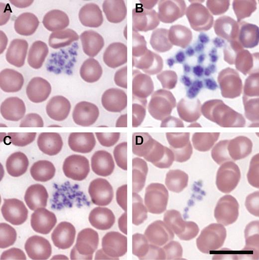 Figure 6. Blood smears showing transgenic rescue of thrombocytopenia. (A) A/J +/+ +/+ with normal-sized platelets, (B) A/J-trac/trac +/+ with enlarged platelets, (C) A/J +/+ Tg (ABCG5/8) with normal-sized platelets, and (D) A/J-trac/trac Tg (ABCG5/8) with normal-sized platelets. Bar represents 10 μm.