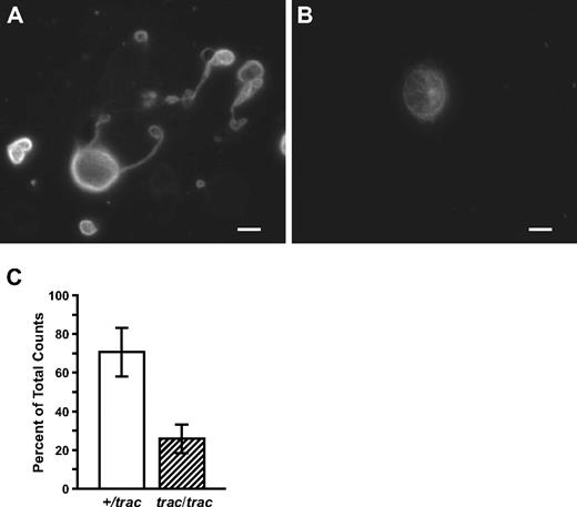 Figure 7. Generation of proplatelets from normal mouse fetal liver cultures. (A) Appearance of normal fetal liver megakaryocytes generating normal proplatelet processes when cultured with 5% A/J +/+ sera. (B) Appearance of normal fetal liver megakaryocytes cultured with 5% A/J-trac/trac sera failing to generate proplatelet processes. Representative samples were stained with rabbit polyclonal antibody SUP GLU, diluted 1:1000, which recognizes detyrosinated tubulin. Bar represents 5 μm. (C) Seventy-one percent of normal fetal liver megakaryocytes generated proplatelet processes when cultured with 5% A/J +/+ sera versus 26% when cultured with 5% A/J-trac/trac sera.