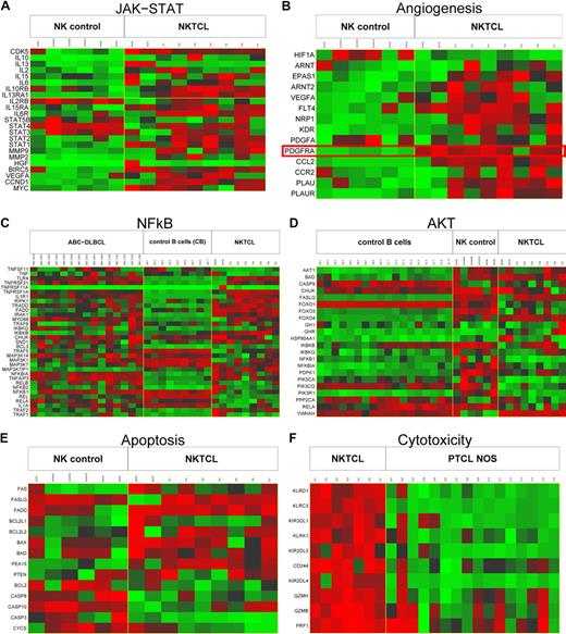 Figure 5. Cellular programs deregulated in NKTCL. Representative molecular pathways differentially expressed in NKTCLs by comparison with either normal NK cells (JAK-STAT in panel A, angiogenesis in panel B, apoptosis in panel E), normal B cells and ABC-DLBCL (NF-κB in panel C), normal NK cells and normal B cells (AKT in panel D), or PTCL, NOS (cytotoxicity in panel F) were illustrated. For each line, green corresponds to the minimal intensity value (min), red corresponds to the maximal intensity value (max), and black corresponds to (min + max)/2. Several genes related to JAK-STAT, angiogenesis, and apoptosis-related pathways are overexpressed in NKTCLs compared with normal NK cells, and genes related to the cytotoxicity-related pathway also are overexpressed in NKTCLs compared with PTCL, NOS. Many genes in the NF-κB and AKT signaling pathways are overexpressed in NKTCLs compared with normal B cells, with a molecular signature similar to that of ABC-DLBCL in NK-κB pathway. The expression data of PDGFRA in NKTCLs, 2 NKTCL-derived cell lines, and normal NK cells is highlighted. T1-7: 7 NKTCL samples; C1-16: 16 PTCL, NOS samples; AcNK, AcNK02, AcNK08, AcNK24: activated NK cells; ReNK, ReNK: resting NK cells; CB.1-8 and CB.11: 9 centroblasts samples; CC.1-8 and CC.11: 9 centrocytes samples; and ABC.2024-2195: 15 ABC-DLBCL samples.