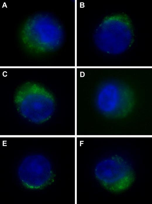 Figure 1. Expression of components of the HLA class I APM in transformed plasma cells. Patients with MGUS are shown on the left; MM on the right. CD138+ cells were immunomagnetically purified from BMMCs and stained with DAPI (blue fluorescence) and with FITC-conjugated mAb (green fluorescence) to proteasome subunits δ (A-B) and LMP2 (C-D) or to the chaperone calnexin (E-F) and examined by epifluorescence microscopy.