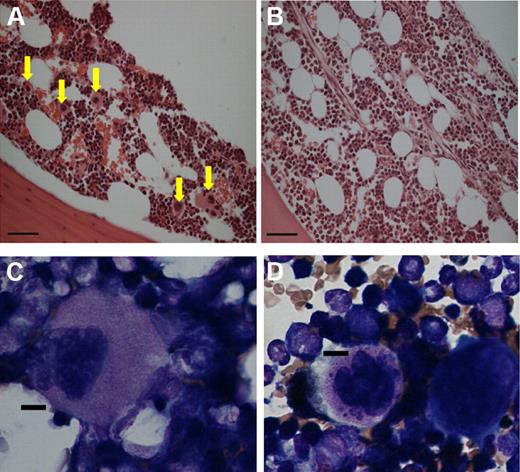 Figure 4. Megakaryocytes are depleted and abnormal in ITP SCID mice. Histologic section of (A) healthy bone marrow and (B) bone marrow from a morbid mouse engrafted with 5 × 104 nondepleted splenocytes (40× magnification; numerical aperture, plan apo; objective lens, 0.75). (A) The yellow arrows point to megakaryocytes, and (A-B) each scale bar represents 50 μm. Because of the paucity of megakaryocytes in SCID mouse ITP bone marrows, the marrows were prepared by a cytospin method to concentrate them on a slide and stained with H&E. (C) An example of a megakaryocyte from the bone marrow of a healthy SCID mouse. (D) H&E staining of a rare megakaryocyte found in the bone marrow of a SCID mouse with ITP (60× magnification; numerical aperture, plan apo; objective lens, 1.4). (C,D) Each scale bar represents 10 μm. All pictures were taken with Nikon Eclipse E800 upright microscope.