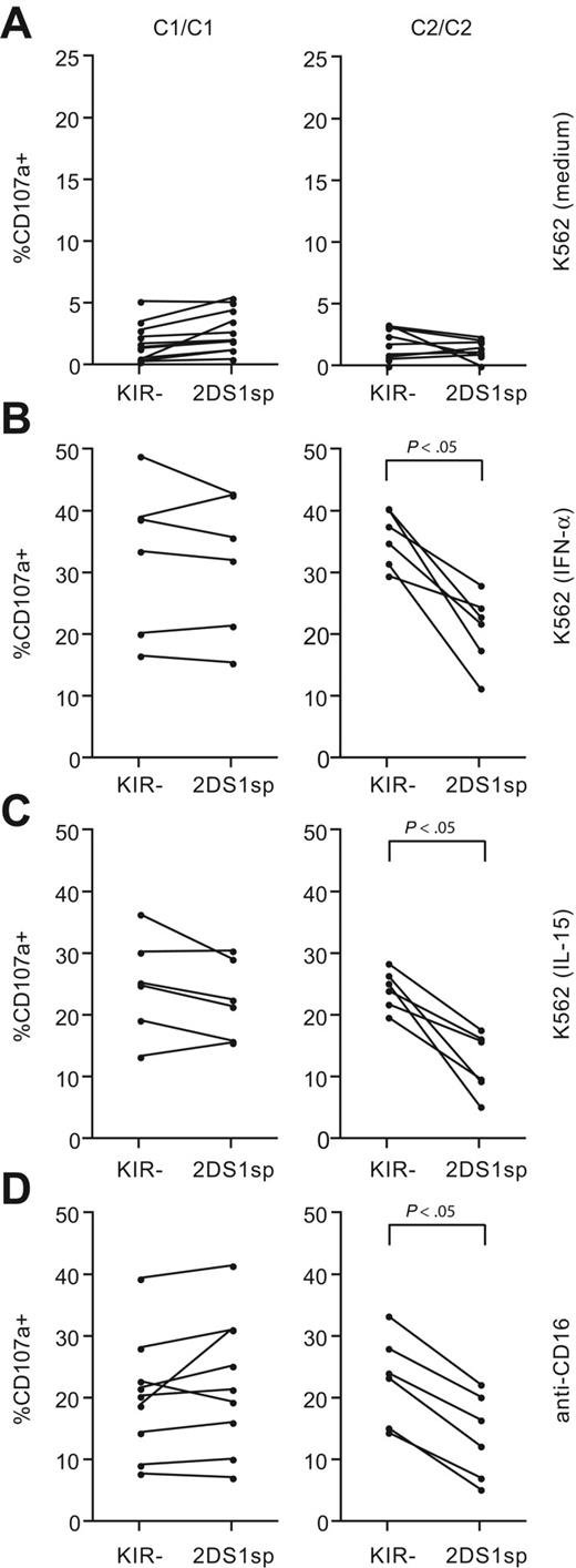 Figure 3. Combined expression of KIR2DS1 and HLA-C2 renders NK cells hyporesponsive to target cell stimulation. Paired analysis of CD107a cell-surface expression after stimulation with K562 cells within NKG2A−KIR− and NKG2A−KIR2DS1sp NK cells cultured overnight in (A) complete medium, (B) 104 U/mL IFN-α, or (C) 10 ng/mL IL-15. (D) Paired analysis of CD107a cell-surface expression after stimulation with P815 cells and anti-CD16 mAb by NKG2A−KIR− and NKG2A−KIR2DS1sp NK cells. (A-D) Left panels represent responses in HLA-C1 homozygous (C1/C1) donors, and right panels represent responses in HLA-C2 homozygous (C2/C2) donors. P values indicate a statistically significant difference between the groups, tested by a Wilcoxon matched-pairs test.