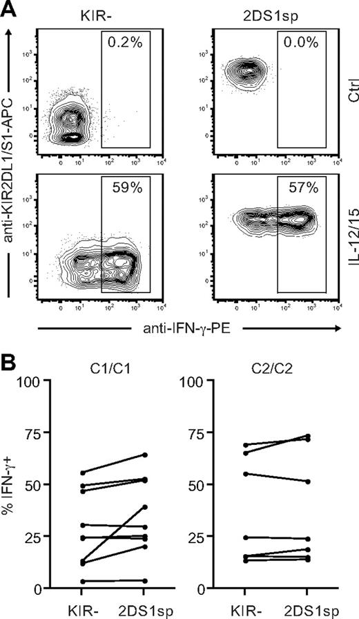 Figure 7. KIR2DS1sp NK cells in HLA-C2 homozygous donors are not hyporesponsive to stimulation with IL-12 and IL-15. (A) Representative example of IFN-γ production by NKG2A−KIR− (left panels) and NKG2A−KIR2DS1sp (right panels) NK cells from a HLA-C2 homozygous donor after culture in medium alone (top panels), and after stimulation with IL-12 and IL-15 in combination (bottom panels). (B) Paired comparison of the frequency of IFN-γ–producing cells within NKG2A−KIR− and NKG2A−KIR2DS1sp NK cells from HLA-C1 homozygous (left panel) and HLA-C2 homozygous (right panel) donors.