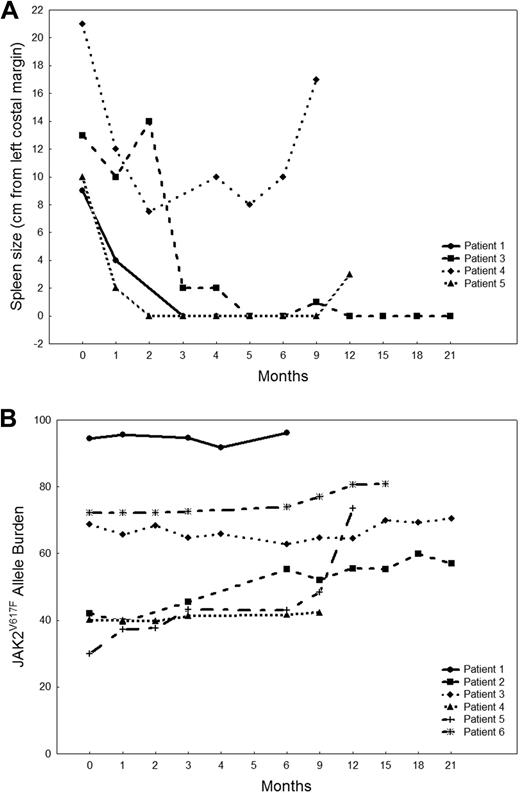 Figure 1. MF patients who responded to CEP-701. (A) Spleen size measurements in MF patients who responded to CEP-701. Data are shown for 4 patients who had a decrease in spleen size on therapy. (B) JAK2V617F allele burden in MF patients who responded to CEP-701. Data are shown for all 6 clinical responders.