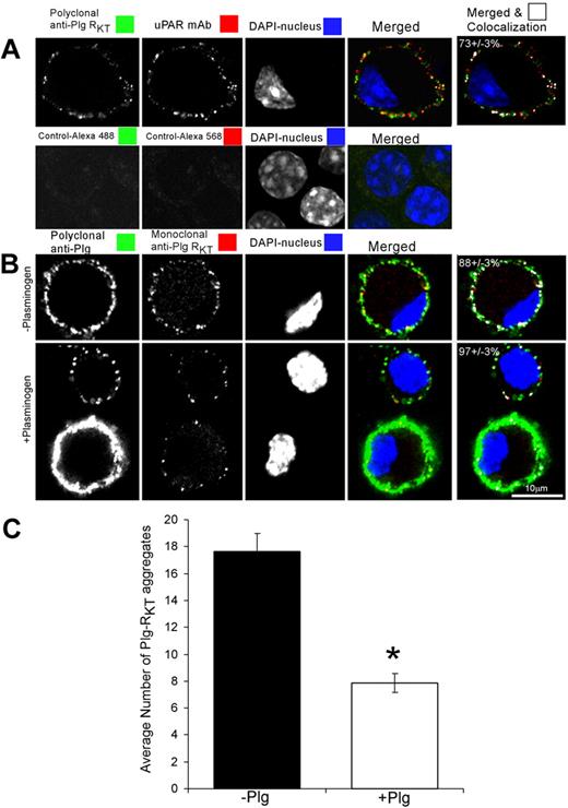 Figure 5. Plg-RKT is dispersed over the cell surface and colocalizes with uPAR. M-CSF–differentiated Hoxa9-ER4 cells were grown on coverslips and incubated with a combination of polyclonal rabbit anti–Plg-RKT IgG (20 μg/mL) and mouse monoclonal anti-uPAR (20 μg/mL; A). Cells were washed, fixed in 1% formaldehyde, and then stained with a combination of Alexa 488-F(ab′)2 fragment of goat anti–rabbit IgG and Alexa 568-F(ab′)2 fragment of goat anti–mouse IgG for 60 minutes at 20°C in PBS containing 0.001% Triton X-100. Controls are samples incubated without first antibody. In panel B, cells were preincubated with either PBS (− plasminogen) or 2μM plasminogen (+ plasminogen) for 10 minutes at 4°C. Then, the cells were fixed in 1% formaldehyde, washed, and then stained with polyclonal anti-Plg IgG or mouse anti–Plg-RKT mAb and stained with a combination of Alexa 488-F(ab′)2 fragment of goat anti–rabbit IgG and Alexa 568-F(ab′)2 fragment of goat anti–mouse IgG. Cells were washed and mounted in Immuno-Fluore Mounting Medium. Images were captured using a Zeiss laser confocal scanning microscope, then imported into LSM Examiner and ImageJ for further processing as described in “Scanning confocal microscopy.” The data in panel C were quantified and the number and size of each labeled aggregate were determined as described in “Scanning confocal microscopy.” The results reflect counts (C) and colocalization correlation coefficient (M1) values (last column in panels A-B) from more than 40 cells in 2 independent experiments. Data represent mean ± SEM. *P < .001.