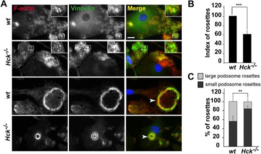 Figure 4. Hck−/− BMDMs do not form large podosome rosettes. BMDMs were seeded on fibronectin-coated coverslips for 24 hours, fixed, and permeabilized. F-actin was stained with Texas red–coupled phalloidin; vinculin, with primary and FITC-coupled secondary antibodies; and nuclei, with DAPI, and cells were examined by fluorescence microscopy. (A top 2 panels) Characteristic podosomes are present in wt and Hck−/− BMDMs with an actin core surrounded by a ring of vinculin (insets). (Bottom 2 panels) wt BMDMs form a large podosome rosette (arrowhead on the Merge image); Hck−/− BMDMs do not form large, but small, podosome rosettes (arrowhead; scale bar represents 10 μm; magnification ×100). (B) Quantification of podosome rosettes in wt and Hck−/− BMDMs. Rosettes were counted in at least 100 cells in duplicate (n = 4). (C) Quantification of small and large rosettes in wt and Hck−/− BMDMs. Hck−/− BMDMs preferentially form small podosome rosettes (n = 4); **P < .01; ***P < .001.