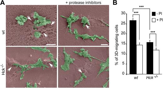 Figure 6. Protease-dependent macrophage migration through Matrigel. (A) Scanning electron microscopy images showing wt and Hck−/− BMDMs (green) on thick Matrigel (brown) transwells in the presence or absence of protease inhibitors. Matrigel remodeling (arrows) is more important with wt than Hck−/− BMDMs and is inhibited by protease inhibitors. Images are showing BMDMs infiltrating the matrix and are representative of 3 experiments (scale bar represents 10 μm). (B) Protease inhibitors inhibit both wt and Hck−/− BMDMs migration through Matrigel. Results are expressed as the percentage of cells that migrate through Matrigel (mean ± SEM; n = 4). ***P < .001.