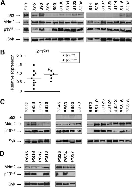Figure 4. Aberrations of the p19Arf-Mdm2-p53 pathway in Slp65-deficient leukemias. (A) Western blot analysis of total cell lysates from pre-B cell tumors from Slp65−/− mice for the expression of p53, p19Arf, Mdm2, and Syk (loading control). (B) Quantitative RT-PCR analyses of p21Cip1 expression in Slp65−/− pre-B cell tumors without or with detectable p53 protein, normalized to GAPDH. Values in sorted WT BM B220+ cells were set to 1. Horizontal lines represent mean values of the relative expression levels. (C) Western blot analysis of total cell lysates from pre-B cell tumors from Btk−/−Slp65−/− mice for the expression of p53, p19Arf, Mdm2, and Syk (loading control). (D) Western blot analysis of total cell lysates from pre-B cell tumors from p53−/−Slp65−/− mice for the expression of p19Arf, Mdm2, and Syk (loading control). Protein of p53 was not detected in p53−/−Slp65−/− tumors.