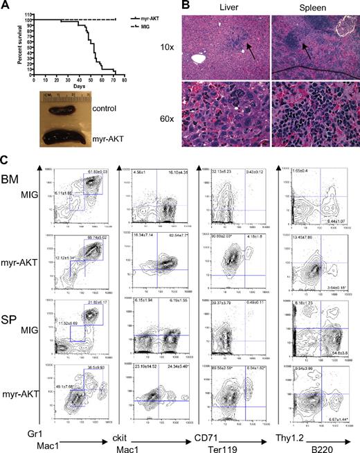 Figure 1. Myeloid expansion in myr-AKT mice. (A) Kaplan-Meier survival curve of 3 separate BMT experiments using myr-AKT retrovirus (n = 30) or MIG empty vector control (n = 5; P < .001). (B) Hematoxylin and eosin–stained histopathology sections of a representative liver and spleen of myr-AKT recipients, revealing infiltration with immature myeloid and erythroid cells (arrows). Details on image acquisition can be found in supplemental Methods. To the left is a photograph of spleens from myr-AKT and MIG control mice. (C) Flow cytometric analysis of the myeloid, lymphoid, and erythroid lineages of BM and spleen (SP) single-cell suspensions from myr-AKT or MIG transplantation recipients. All were gated for GFP+ cells. Values are the mean ± SEM. *P < .05.