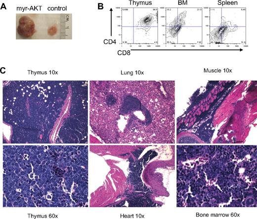 Figure 2. T-cell lymphoma in myr-AKT mice. (A) Photograph of the thymus from a myr-AKT mouse and a MIG control mouse. (B) Flow cytometric analysis of thymus, BM, and spleen single-cell suspensions from a myr-AKT mouse with T-cell lymphoma. Representative plots are shown. All were gated for GFP+ cells. (C) Hematoxylin and eosin–stained histopathology sections of thymus, lung, heart, BM, and muscle sections of a myr-AKT mouse with T-cell lymphoma. Details on image acquisition can be found in supplemental Methods.