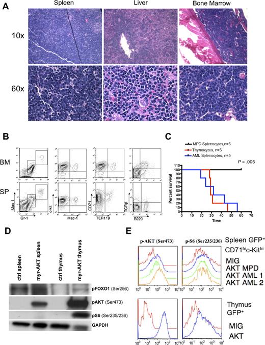 Figure 3. AML in myr-AKT mice. (A) Hematoxylin and eosin–stained histopathology sections of spleen, liver, and BM from a representative myr-AKT mouse with AML. Details on image acquisition can be found in supplemental Methods. (B) Flow cytometric analysis of BM and spleen cells from a representative myr-AKT mouse with AML. All were gated for GFP+ cells. (C) AML and T-cell lymphoma are transplantable, whereas MPD is not. Kaplan-Meier survival curves representing secondary transplantations of splenocytes from myr-AKT mice with MPD, thymocytes from myr-AKT mice with T-cell lymphoma, or splenocytes from myr-AKT mice with AML injected into the tail veins of sublethally irradiated C57 Bl/6 mice. MPD secondary transplantation mice were followed for 120 days with no evidence of disease. (D) Western blot of representative splenocyte and thymocyte lysates from diseased myr-AKT mice and a WT age-matched control mouse. (E) Intracellular flow cytometry on GFP-gated thymocytes and GFP-gated CD71hic-Kithi splenocytes from a myr-AKT mouse and a WT age-matched control mouse.
