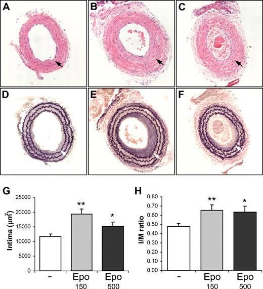 Figure 1. Epo accelerates SMC-rich lesion formation in mice. Comparison of the intima formation of ligated carotid arteries of wild-type FVB mice treated with solvent (A,D), 150 IU/kg Dynepo (B,E), or 500 IU/kg Dynepo (C,F). The mean intimal area (F) and intima/media (I/M) ratio (G) reveal significantly enhanced intima formation in Epo-treated groups after 4 weeks of ligation. Photomicrographs of hematoxylin-eosin–stained (A-C) and Lawson solution–stained (D-F) sections: bright-field microscopy, original magnification ×200. Mean and SEM of different treatment groups are shown (G-H). Student t test vs control: *P < .05; **P < .01.