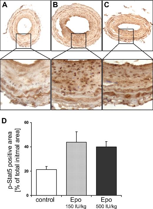 Figure 4. Epo stimulates Stat5 phosphorylation in the injured vessel wall. Stat5 phosphorylation was investigated by immunohistochemical staining of sections from ligated carotid arteries of mice treated with solvent (A), 150 IU/kg Dynepo (B), or 500 IU/kg Dynepo (C). Representative pictures are shown, and were captured with bright-field microscopy at an original magnification of ×200. (D) The percentage of total intima surface that stained positive for phosphorylated Stat5. Mean and SEM of 4 sections per treatment group are shown. Student t test versus control: **P < .01.