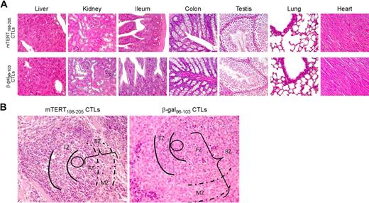 Figure 6. Immunopathology related to TERT-based ACT: tissue histology. (A) Both mTERT-specific (top) and β-gal–specific (bottom) CTL-treated mice did not show any morphologic alteration of liver, kidney, small and large intestine, testis, lungs, and heart as assessed by histologic analysis. Liver sections from treated and control mice showed typical polygonal arrangement of lobules. Portal triads were regularly distributed; neither portal nor centrolobular degeneration was present. Renal specimens of both experimental groups showed normal renal cortex. There were no evidence of glomerular hypercellularity or an increase in thickness of capillary walls, nor was there flogosis or fibrosis of tubulointerstitial compartment. Small (ileum) and large (colon) intestine sections appeared normal: there was no damage of the villous architecture or glandular distortion, and there were no flogistic or fibrotic alterations of the lamina propria. In the testis of mTERT-specific CTL-treated and control-treated mice, seminiferous tubules were normal in size and number; there were no alterations of spermatogenic cell maturation. Healthy lung parenchyma from mTERT-specific CTL-treated and control groups was composed by flat walled alveoli with interposed thin layer of connective tissue and normal bronchial tree. No pathologic alterations were found in heart: normal myocardium composed of striated muscle fibers is shown. (B) Spleen of mTERT-specific CTL-treated mice showed impaired architecture respect to control samples: B-cell rich outer compartment of periarteriolar lymphoid sheets (parentheses, BZ) had a reduced thickness of both follicular (FZ) and marginal zones (dashed lines, MZ). T-cell inner zone (solid lines, TZ) was normal in both groups.