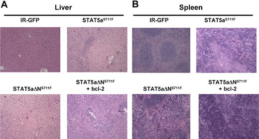 Figure 6. STAT5aΔNS711F-expressing cells confer a milder form of MPD, which is restored to aggressive disease by transgenic human bcl-2 expression. STAT5abnull/null FL cells at E14.5 and E15.5 were transduced with either MSCV/IRES-GFP vector control (IR), STAT5aS711F, or STAT5aΔNS711F and transplanted into lethally irradiated recipient mice. Tissues from mice that underwent transplantation were collected and formalin-fixed, and histologic sections were stained with hematoxylin and eosin. Representative sections of liver (A) and spleen (B) are shown. Histologic sections were prepared for mice expressing IR-GFP, STAT5aS711F, and STAT5aΔNS711F + bcl-2 groups at < 30 days after transplantation. For mice that received STAT5aΔNS711F-expressing BM cells that survived long term, the histology was performed at the end of the survival curve (80-90 days). Images were taken using an Olympus BX41 microscope equipped with PanAchromatic objectives (20×) and a mounted Spot In-Sight digital camera (Diagnostic Instruments Inc). The software for image acquisition was Spot Advance. Image processing was done in Adobe Photoshop.