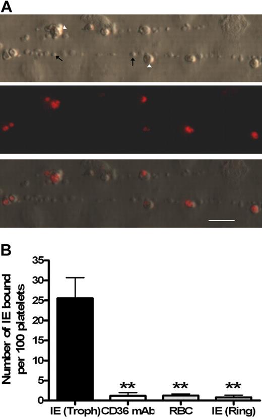 Figure 1. Only mature Plasmodium falciparum–infected erthryocytes are able to bind to platelet-decorated VWF strings on endothelial cells stimulated with histamine. (A) Ethidium bromide–labeled parasites (Δ) are the only red blood cell species binding to the platelet–decorated VWF strings ↑. Flow direction is from left to right. (B) Trophozoite (Troph) IE binding to strings (n = 11) was significantly blocked by a CD36 monoclonal antibody (n = 4). Similarly, binding was not observed in the presence of uninfected red blood cells (n = 4) or with ring-stage IE (n = 3). Bar represents 20 μm. **P < .005.