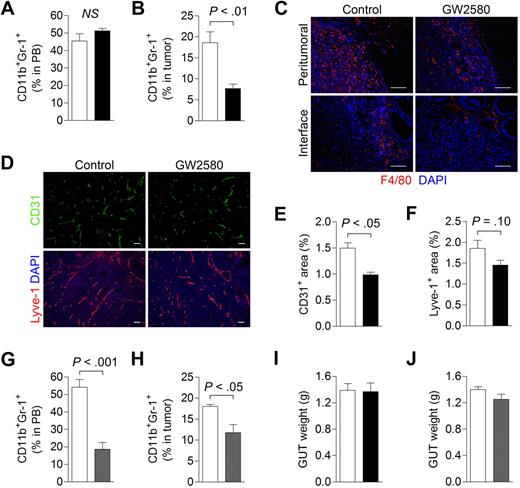 Figure 5. Targeting MDSC infiltration and tumor angiogenesis in orthotopic RM-1 prostate tumors. RM-1 prostate tumor cells were implanted intraprostatically in the dorsolateral lobes of C57BL/6 males. Mice were treated with control diluent, GW2580, PBS, or clodronate liposomes (Clodrolip) at the appropriate dosing regimen. (A) Peripheral blood (n = 5/group) total MDSCs were analyzed by flow cytometry in control (white bar) and GW2580-treated (black bar) mice. (B) Tumor-associated MDSC levels (n = 3-5/group) were also analyzed by flow cytometry in control and GW580-treated mice. (C) Tumor tissue was processed and subjected to histologic staining of F4/80+ TAMs at the peritumoral regions (top) and normal prostate-tumor interface (bottom). (D) Representative CD31+ blood and Lyve-1+ lymphatic vascular staining of RM-1 prostate tumors from control and GW2580-treated mice are shown. Quantification of CD31+ (E) and Lyve-1+ (F) area was performed using ImageJ software (n = 3-5/group). (G-H) Peripheral blood (n = 5/group) and tumor-associated MDSC (n = 3 or 4/group) levels were analyzed by flow cytometry in PBS- (white bar) and Clodrolip-treated (gray bar) mice. Genitourinary tract (GUT) weight was measured at endpoint in GW2580-treated (I) and Clodrolip-treated (J) mice (n = 3-5/group). Scale bars represent 100 μm.