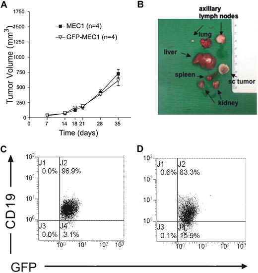 Figure 1. MEC1 cells injected subcutaneously grow and substantially localize in several organs of Rag2−/−γc−/− mice. (A) Rag2−/−γc−/− male mice received a transplant subcutaneously in the left flank of MEC1 cells with or without GFP expression (10 × 106 cells/mouse; n = 4, repeated twice), showing no significant difference in tumor engraftment. Tumor size was evaluated by measuring perpendicular diameters by a caliper. Animals were killed when the tumor volume reached 1000 mm3. (B) Organs from these animals were collected and analyzed macroscopically. (C) Peripheral blood was extracted from Rag2−/−γc−/− male mice injected subcutaneously with MEC1 cells expressing GFP and killed when the tumor volume reached a dimension of 1000 mm3. The dot plot analysis shows the intensity of the staining with monoclonal antibody (mAb) against human CD19, after gating on the GFP+ leukemic B-cell population. (D) Peritoneal exudate was extracted from Rag2−/−γc−/− male mice injected subcutaneously with MEC1 cells expressing GFP and killed when the tumor volume reached a dimension of 1000 mm3. The dot plot analysis shows the intensity of the staining with mAb against human CD19, after gating on the GFP+ leukemic B-cell population.