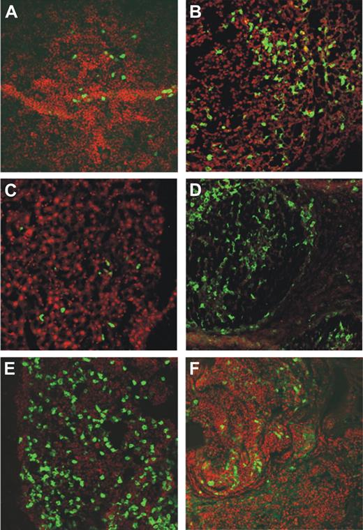 Figure 2. MEC1 cells injected subcutaneously localize in several organs of Rag2−/−γc−/− mice. Organs from Rag2−/−γc−/− male mice injected subcutaneously with MEC1 cells expressing GFP and killed when the tumor volume reached a dimension of 1000 mm3 were collected and analyzed by confocal microscopy (spleen, kidney, liver, axillary tumor-draining lymph node, bone marrow, and tumor represented in panels A, B, C, D, E, and F, respectively). The extent and pattern of invasion is demonstrated by the presence of green GFP+ leukemic cells. Cell nuclei were stained with TO-PRO3 showing in red.