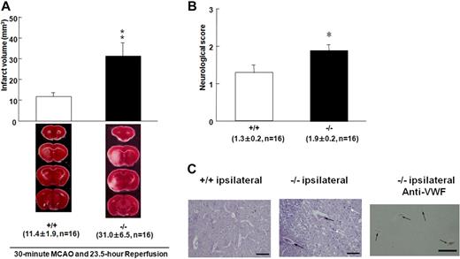 Figure 2. Effect of Adamts13 gene deletion on brain infarct in mice after 30-minute MCAO. (A) These are coronal sections through the brain in both groups stained with 2,3,5 triphenyltetrazolium chloride. Red areas represent vital brain tissue, and white areas represent cerebral infarction. Adamts13−/− (−/−) mice had significantly larger volume of brain infarct compared with wild-type (+/+) mice after 23.5-hour reperfusion after 30-minute MCAO (−/−, n = 16, vs +/+, n = 16, **P < .01, Student t test). Values are mean ± SEM (mm3). The average infarct volume was 31.0 ± 6.5 mm3 for ADAMTS13 −/− mice and 11.4 ± 1.9 mm3 for +/+ mice. The survival rates of the −/− and +/+ mice did not differ (17 of 20 vs 16 of 20, respectively). No ischemic change was observed in the brain of −/− and +/+ mice after sham operation. (B) Neurologic score was measured 24 hours after MCAO. Neurologic scores were measured from the point according to the neurologic findings as follows: 0 indicates normal motor function; 1, flexion of torso and of contralateral forelimb on lifting of the animal by the tail; 2, circling to the ipsilateral side but normal posture at rest; 3, circling to the ipsilateral side; 4, rolling to the ipsilateral side; and 5, leaning to the ipsilateral side at rest (no spontaneous motor activity). *P < .05. (C) Representative PTAH-stained sections of infarct area for wild-type (+/+) and Adamts13−/− (−/−) mice. There were more thrombi and inflammatory cells in the lesions of Adamts13−/− mice compared with +/+ mice (black arrows represent thrombus; white arrow, inflammatory cells infiltration). The area comparable with PTAH staining for −/− mice was immunostained using anti-VWF antibody. VWF is detected in thrombi as brown staining (−/− ipsilateral anti-VWF). Images were generated using an Olympus BH-2 microscope with an Olympus DP20-5 digital camera (original magnification ×200). Bar represents 40 μm.