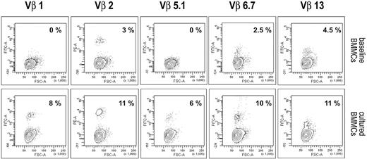 Figure 4. TCR Vβ analysis of precultured BMMCs and the derived 13-day culture from patient 1. Cytofluorimetric analysis of 6 Vβ families in BMMCs and the derived p190BCR-ABL–stimulated 13-day culture are shown. The presence of expanded populations within Vβ 1, Vβ 2, Vβ 5.1, Vβ 6.7, and Vβ 13 demonstrates polyclonality of the response driven by the antigen.