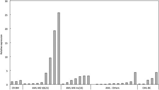 Figure 6. EVI5 is overexpressed in human RUNX leukemia. qRT-PCR analysis of EVI5 expression in human RUNX1-related leukemia samples: AML M2 with t(8;21) resulting in RUNX1-ETO fusion protein, AML M4 with inv(16) resulting in PEBP2β-SMMHC fusion protein, other AML cases without RUNX1 alteration and CML cases with blast crisis (CML-BC). Data are represented as fold change relative to BM samples undergoing complete remission (CR-BM).