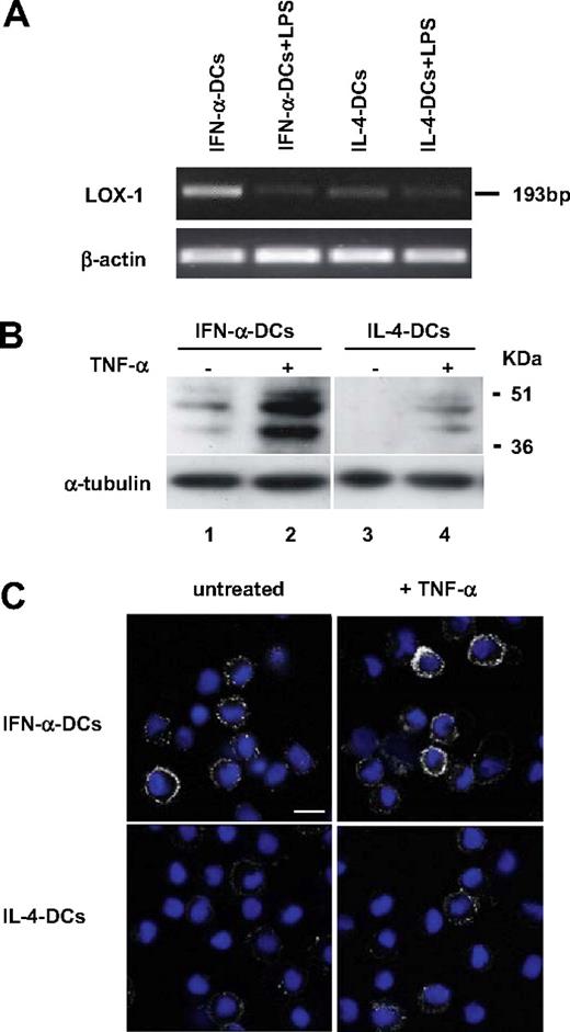 Figure 2. Selective LOX-1 expression in IFN-α DCs. (A) Semiquantitative PCR analysis of LOX-1 expression in IFN-α DCs and IL-4 DCs at basal levels or after LPS stimulation. Data are representative of 3 independent experiments with DCs derived from different donors. (B) LOX-1 protein expression in IFN-α DCs and IL-4 DCs cultured with or without TNF-α. All blots were probed with rat anti–human LOX-1 antiserum. LOX-1 protein appears as 3 different glycosylated forms in acrylamide gel electrophoresis. Data are representative of 4 independent experiments. (C) CLSM analysis showing the expression of LOX-1 on the surface membrane of DCs. Nuclear staining by DAPI (blue). Data are representative of 3 independent experiments. Scale bars, 10 μm.