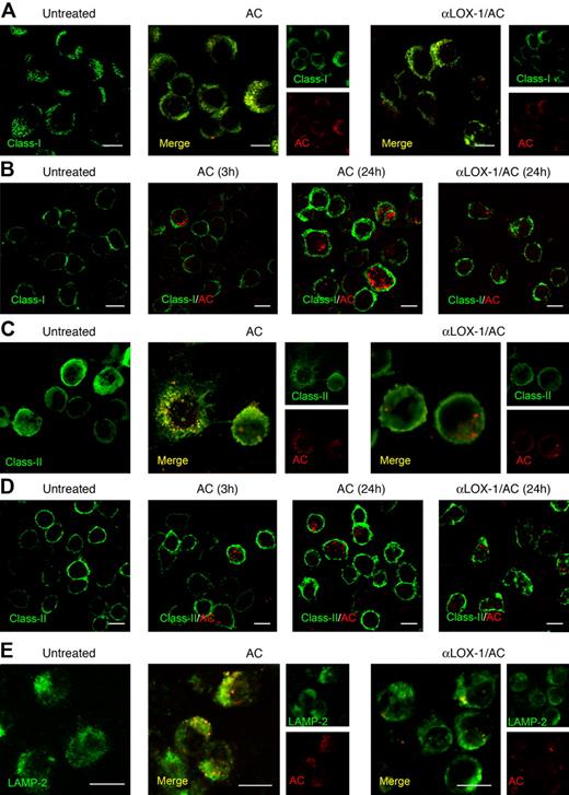 Figure 6. MHC-I and MHC-II molecules rearrange and colocalize with ACs in IFN-α DCs upon AC uptake. CLSM analysis (central optical sections) of IFN-α DCs incubated or not with anti–LOX-1 mAb before the coculture with PHK26-PE–labeled AC. (A,C,E) After a 24-hour coculture, IFN-α DCs were fixed, made permeable, and stained with FITC-conjugated anti–MHC-I (A), anti–MHC-II (C), or with LAMP-2 (E) antibodies. Colocalization of staining is shown in merged images (yellow). In panels B and D, the up-regulation of MHC-I and MHC-II levels on unfixed IFN-α DCs was analyzed over time, after 3 and 24 hours of coculture with ACs. Scale bars correspond to 10 μm. Images were observed through a 63× oil-immersion objective lens. Data are representative of 3 independent experiments.
