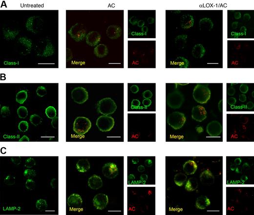 Figure 7. MHC-I, MHC-II and LAMP-2 distribution after AC uptake in IL-4 DCs. CLSM analysis (central optical sections) of IL-4 DCs incubated or not with anti–LOX-1 mAb before 24-hour coculture with PHK26-PE–labeled ACs. DCs were fixed, made permeable, and then stained with FITC-conjugated anti–MHC-I (A), anti–MHC-II (B), or with LAMP-2 antibodies (C). Colocalization of ACs with the mentioned molecules is shown in yellow; scale bars, 10 μm. Data are representative of 3 independent experiments.