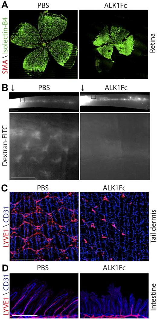 Figure 2. ALK1Fc causes vascular and lymphatic defects. (A) Isolectin-B4 (green) and SMA (red) staining of P8 retina from PBS- or ALK1Fc-treated pups (10 mg/kg; P1 P3, P5). (B) Analysis of lymphatic function by dextran–FITC injection into the tail tip () of a P5 pup treated with PBS or ALK1Fc (10 mg/kg, P1 and P3). Images were captured 5 minutes after injection. (Top) Drainage of dextran–FITC into the collecting lymphatic vessel that extends the length of the tail. Scale bar represents 1 mm. (Bottom) “Honeycomb” lymphatic vessels in the dermis adjacent to the injection site (box). Scale bar represents 250 μm. (C) CD31 (blue, vasculature) and LYVE1 (red, lymphatic) staining of the tail dermis from PBS- or ALK1Fc-treated pups (10 mg/kg, P1 and P3) at P6. Scale bar represents 250 μm. (D) CD31 (blue, vasculature) and LYVE1 (red, lymphatic) staining of the intestine from PBS- or ALK1Fc-treated pups (10 mg/kg, P1 and P3) at P6. Scale bar represents 250 μm.