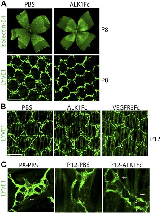 Figure 4. ALK1 is involved in multiple stages of lymphatic development. (A) Analysis of vascular and lymphatic development in P8 pups when ALK1Fc treatment is started when the honeycomb pattern is being established (10 mg/kg, P3 and P5). Lymphatic development is visualized by LYVE1 (green) staining in the tail dermis, whereas vascular development is visualized by isolectin-B4 (green) staining of the retina. Scale bar represents 500 μm (retina) and 250 μm (tail). (B) Analysis of lymphatic development in P12 pups when ALK1 treatment is started when the honeycomb structure is fully established (10 mg/kg, P8 and P10). Lymphatic development is visualized by LYVE1 (green) staining in the tail dermis. Scale bar represents 250 μm. (C) High-magnification images demonstrate the remodeling process that occurs from P8 to P12 and the “ringed” structures that fail to be remodeled in ALK1Fc-treated pups.