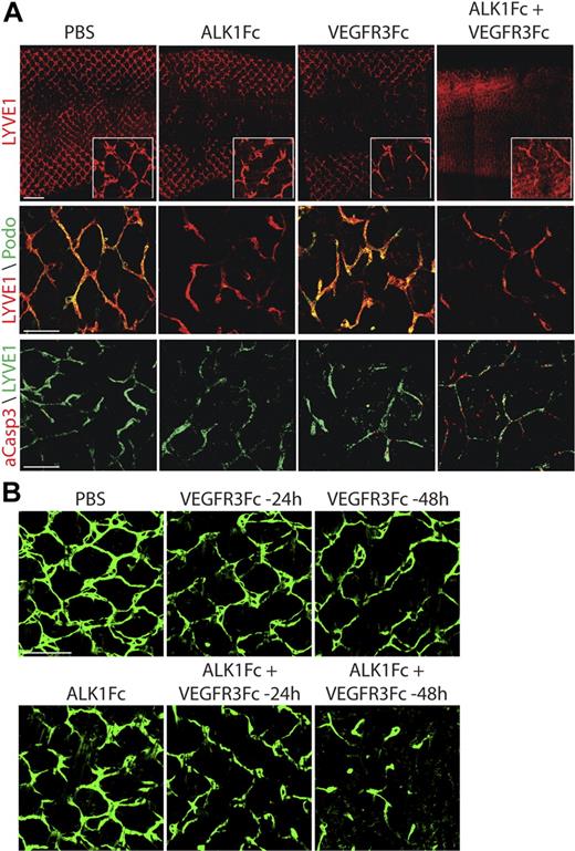 Figure 5. Distinct roles of ALK1 and VEGFR3 during lymphatic development. (A top) Analysis of lymphatic development in P4 pups after treatment with ALK1Fc (10 mg/kg, P2), VEGFR3Fc (1 mg/kg, P1), or combined ALK1Fc and VEGFR3Fc. Lymphatic development is visualized by LYVE1 staining (red), inset shows a greater magnification image of the honeycomb structure that is disrupted by the treatments. Scale bar represents 500 μm. (Middle) Analysis of podoplanin (green) and LYVE1 (red) expression after ALK1Fc, VEGFR3Fc, or combination treatments. Scale bar represents 250 μm. (Bottom) Analysis of LYVE1 (green) and active Caspase3 (red) expression after ALK1Fc, VEGFR3Fc, and combination treatment. Scale bar represents 250 μm. (B) Analysis of lymphatic development in P8 pups after ALK1Fc (10 mg/kg, P3 and P5), VEGFR3Fc (10 mg/kg, P6 or P7), or combined ALK1Fc and VEGFR3Fc treatment. Lymphatic development is visualized by LYVE1 staining (red). Scale bar represents 250 μm.