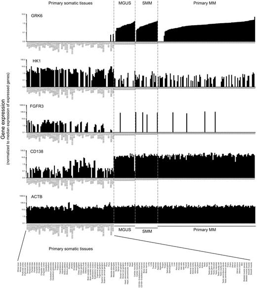 Figure 4. Expression of selected myeloma survival kinases in primary multiple myeloma versus an atlas of nonhematopoietic human tissues. Histograms show the differential patterns of expression of myeloma survival kinases (GRK6, HK1, and FGFR3) and of control genes (CD138 and β-actin) in primary human somatic tissues (103 arrays), primary multiple myeloma tumor cells (115 arrays), and in early stage plasma cell disorders: monoclonal gammopathy of uncertain significant (MGUS) and smoldering multiple myeloma (SMM; data from SymAtlas, Novartis Research Foundation and from Mayo Clinic; GEO accession no. GSE 6477). Array-based gene expression data were normalized per chip (sample) to the median signal intensity of expressed genes (genes with present detection call and/or MAS5 signal intensity > 200); a value of 1.0 thus represents the median expression intensity of genes whose expression can be reliably detected within each sample type.