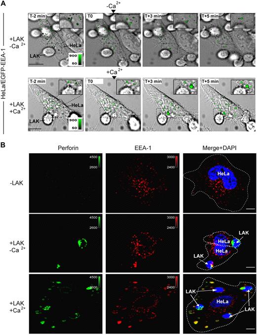 Figure 2. Large endosomes (gigantosomes) form in target cells within minutes of triggering CTL degranulation. (A) Large EEA-1+ endosomes form in a target cell after CTL degranulation. EGFP–EEA-1–transfected HeLa target cells were incubated with specific CTLs in the presence of EGTA to allow conjugate formation. After 2 minutes, CaCl2 was added to induce CTL degranulation (bottom; images from supplemental Videos 1-2). Enlarged endosomes form in the target cell within minutes after CTL degranulation, although the size of early endosomes does not change in the absence of calcium (top). Data (deconvolved wide-field images) are representative of 3 independent experiments. (B) Large endosomes formed in target cells after CTL attack contain PFN. Concanavalin A–coated HeLa cells were incubated with LAK cells in the presence of EGTA to allow conjugate formation, and then buffer (top) or CaCl2 (bottom) was added to induce cytotoxic granule exocytosis 5 minutes before fixation. Data depicted (deconvolved wide-field 3-dimensional images followed by Z projection) are representative of 2 independent experiments. PFN signal was detected using AlexaFluor 488–conjugated secondary antibody and EEA-1 using AlexaFluor 647–conjugated secondary antibody. Color bars and associated numbers indicate fluorescence intensity levels. Scale bars represent 10 μm. Dashed lines indicate plasma membrane.