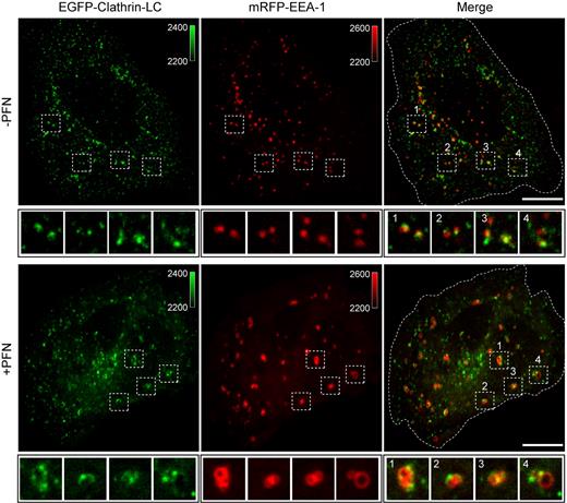 Figure 3. Gigantosomes are coated with clathrin. HeLa cells stably expressing EGFP-CLC (green) and transfected with mRFP–EEA-1 (red) were analyzed by live 3-dimensional confocal capture 10 minutes after sublytic rPFN treatment. In the presence of rPFN, gigantosomes stained with EEA-1 (red), colocalize with clathrin (green) as indicated. One representative optical section obtained from sequential 0.1-μm optical sections (supplemental Videos 3-4) is shown for each condition. Most of the gigantosomes (red) are coated with clathrin (green). Data are representative of 5 independent experiments. Color bars and associated numbers indicate fluorescence intensity levels. Scale bars represent 10 μm. Dashed lines indicate plasma membrane.