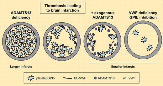 The GPIb-VWF axis in experimental stroke development. In the postischemic cerebral microvasculature, UL-VWF released from activated or damaged endothelial cells and platelets promotes platelet recruitment and thrombus growth. In flowing blood, UL-VWF is cleaved by ADAMTS13 to smaller VWF multimers that are less adhesive and circulate in plasma. Absence of ADAMTS13 leads to increased thrombus formation and larger infarctions, whereas infusion of exogenous ADAMTS13 reduces thrombotic activity and infarct size. An even stronger inhibition of thrombotic activity and, consequently, markedly reduced infarct size is achieved by inhibition of GPIb or absence of VWF.
