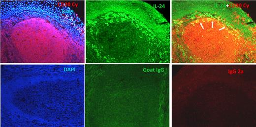 Figure 4. The detection of IL-24–positive cells in follicular B cells on OCT-embedded frozen sections. (Top left) Section was stained with anti-CD20cy MAb followed by a secondary Alexa 594 F(ab)′2-goat anti–mouse Ab, and DAPI-containing mounting medium. (Middle) Goat anti–human IL-24 Ab was followed by biotinylated rabbit anti–goat Ab and streptavidin–Alexa 488. (Right) Section was stained sequentially with anti–IL-24 then with anti-CD20 Abs. (Bottom panels from left to right) Controls are in order: DAPI, goat IgG + biotin–anti-goat + SA–Alexa 488, mouse IgG2a + Alexa 594 goat anti–mouse Ab.
