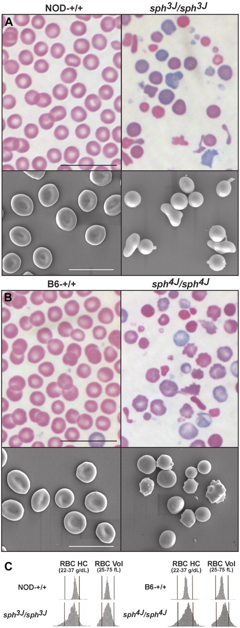 Figure 2. Abnormal erythrocyte morphology. (A) Peripheral blood smears and scanning electron photomicrographs from control (NOD-+/+) and homozygous mutant (sph3J/sph3J) mice, and (B) control (B6-+/+) and homozygous mutant (sph4J/sph4J) mice. Bars, 10 μm. (C) RBC hemoglobin concentration (RBC HC) and volume distribution (RBC Vol) histograms.