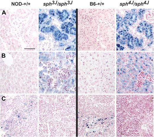 Figure 3. Tissue pathology. Prussian blue staining of kidney (A), liver (B), and spleen (C) tissue sections from (left to right) NOD control (NOD-+/+), sph3J/sph3J mutant, B6 control (B6-+/+), and sph4J/sph4J mutant mice. Note the extensive iron accumulation in kidney tubules and liver parenchyma of mutant mice. Mutant liver sections also contain numerous foci of extramedullary hematopoiesis. Bars, 100 μm.