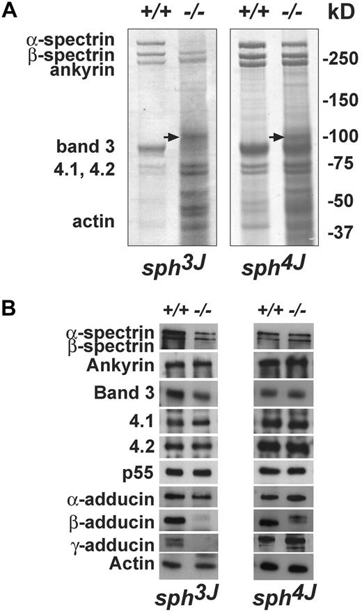 Figure 4. Erythrocyte membrane skeletal defects. (A) Coomassie blue-stained SDS-PAGE gels. Equal volumes of normal and mutant packed RBC ghosts/lane were loaded. The high percentage of circulating reticulocytes in mutants results in numerous additional bands and an overall smeared appearance, especially in the lower molecular weight ranges, on SDS-PAGE gels. The species indicated by the arrow is unknown; it is not band 3 because it is also present in band 3-null RBC ghosts.34 (B) Western blots of RBC ghost proteins probed with the indicated antibodies. Each panel is representative of results from multiple blots. +/+, wild-type; −/−, homozygous mutant.