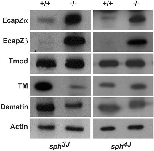 Figure 5. Other erythrocyte actin-associated proteins. Western blots of RBC ghost proteins probed with the indicated antibodies. Each panel is representative of results from multiple blots. TM indicates tropomyosin; Tmod, tropomodulin; +/+, wild-type; −/−, homozygous mutant.