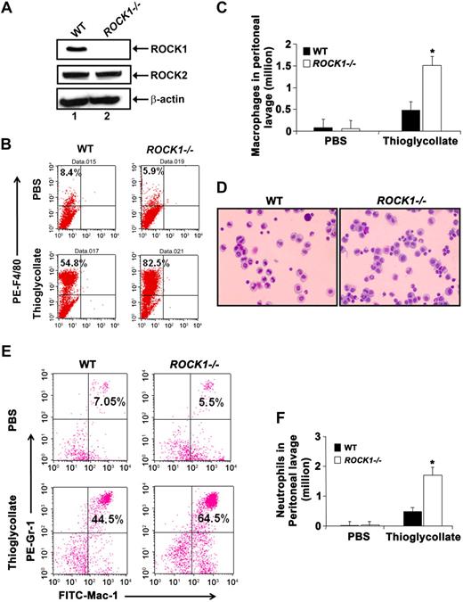 Figure 1. Increased recruitment of macrophages and neutrophils into the inflamed peritoneum of ROCK1−/− mice. (A) Western blot analysis demonstrating the expression of ROCK1 and ROCK2 in BMMs from WT and ROCK1−/− mice. Equal amounts of cell lysate were probed with antibodies specific for the coiled-coil region of ROCK1 or ROCK2, respectively. The same blot was reprobed for β-actin to show protein loading in each lane. Lanes 1 and 2 represent lysates derived from WT and ROCK1−/− BMMs, respectively. The top arrow indicates expression of ROCK1 in WT BMMs but not in ROCK1−/− BMMs; the middle arrow indicates the expression of ROCK2 in both WT and ROCK1−/− BMMs; the bottom arrow indicates β-actin expression in WT and ROCK1−/− BMMs; n = 3. (B) WT and ROCK1−/− mice were given intraperitoneal injections of 4% thioglycollate. Peritoneal lavage was collected 4 days after injection, and mature macrophage-specific marker F4/80 expression was examined by flow cytometry. Top left quadrant of each dot blot represents the percentage of PE-conjugated F4/80-positive cells in WT and ROCK1−/− peritoneum after PBS or thioglycollate injections. Dot blots shown are representative of macrophages recruited into the peritoneal cavity of WT and ROCK1−/− mice, analyzed after PBS or thioglycollate injection. Similar results were obtained in 7 other mice from each genotype examined. (C) A representative bar graph shown here is the total number of macrophages recruited into the peritoneal cavity. Results shown are from one independent experiment containing 3 pairs of mice from each genotype after PBS or thioglycollate injection. WT vs ROCK1−/− mice, *P < .01. Similar results were obtained in 2 other independent experiments using 5 mice of each genotype (n = 3, 8 pairs of WT and ROCK1−/− mice). (D) Representative micrograph shown is a cytospin preparation of macrophages elicited by thioglycollate treatment from the peritoneal cavity of WT and ROCK1−/− mice. Peritoneal macrophages were stained with Wright-Giemsa. Images were acquired through a Zeiss Axioskop 2 Plus microscope equipped with a Plan-Neofluar 20×/0.5 objective lens, and were captured with an Axiocam MRC-5 camera and Axiovision 4 software (all from Carl Zeiss). (E) Increased recruitment of neutrophils to the inflamed peritoneum of ROCK1−/− mice. WT and ROCK1−/− mice were given intraperitoneal injections of 4% thioglycollate. Peritoneal lavage was collected after 4 hours of injection, and Gr-1/Mac-1 expression was examined by flow cytometry. Top right quadrant of each dot blot represents percentage of Gr-1 and Mac-1 double-positive cells in the peritoneum after PBS or thioglycollate injections. Dot blots shown are representative of neutrophils migrated into the peritoneum of WT and ROCK1−/− mice, analyzed after PBS or thioglycollate injection. Similar results were obtained in 4 other mice from each genotype examined. (F) A representative bar graph shows the total number of neutrophils recruited into the peritoneal cavity. Results are from one independent experiment containing 3 pairs of mice of each genotype after PBS or thioglycollate injection. WT vs ROCK1−/− mice, *P < .05. Similar results were obtained from one other independent experiment containing 2 mice of each genotype (n = 2, 5 pairs WT and ROCK1−/− mice).