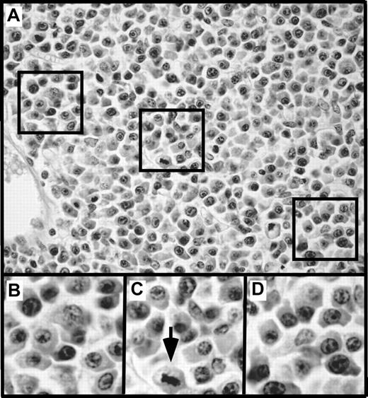 Figure 7. Plasma cell hyperplasia in young, tumor-free C.IL6/iMyc mice. (A) Low-power view of an abnormal accumulation of plasmablasts and plasma cells in an enlarged peripheral lymph node of a 4-week-old C.IL6/iMycCα mouse (H&E stain; original magnification, ×20; final magnification, ×50). The 3 areas indicated by squares are shown below at higher power (final magnification, ×100; B-D). The arrow in panel C denotes cell that is undergoing division.