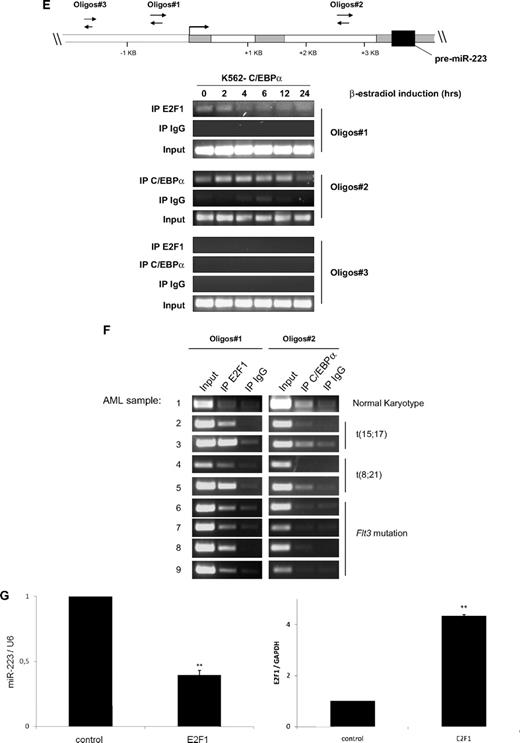 Figure 4. E2F1 functions as a repressor of the miR-223 gene. (A) Schematic representation of the different miR-223 promoter constructs used for reporter assays. (B-D) Luciferase reporter assays were performed in U937 cells using indicated reporters and E2F1 (B) and C/EBPα (C-D). Bars represent promoter activity for the corresponding vectors. Data are represented as mean ± SD from 3 independent experiments. *P < .05; **P < .01. (E-F) Chromatin derived from K562-C/EBPα-p42-ER cells (E) and AML blast cells (F) was immunoprecipitated with anti-E2F1, anti-C/EBPα, and immunoglobulin G antibodies. Recovered DNA was PCR amplified with primers specific for the E2F1 binding amplicon (oligo 1) and C/EBPα binding amplicon (oligo 2). (G) U937 cells were transfected with control or E2F1 vector. Total RNA was analyzed by quantitative RT-PCR with oligos for miR-223 (top) and with oligos for E2F1 (bottom). Data are represented as mean ± SD from 3 independent experiments. *P < .05; **P < .01.
